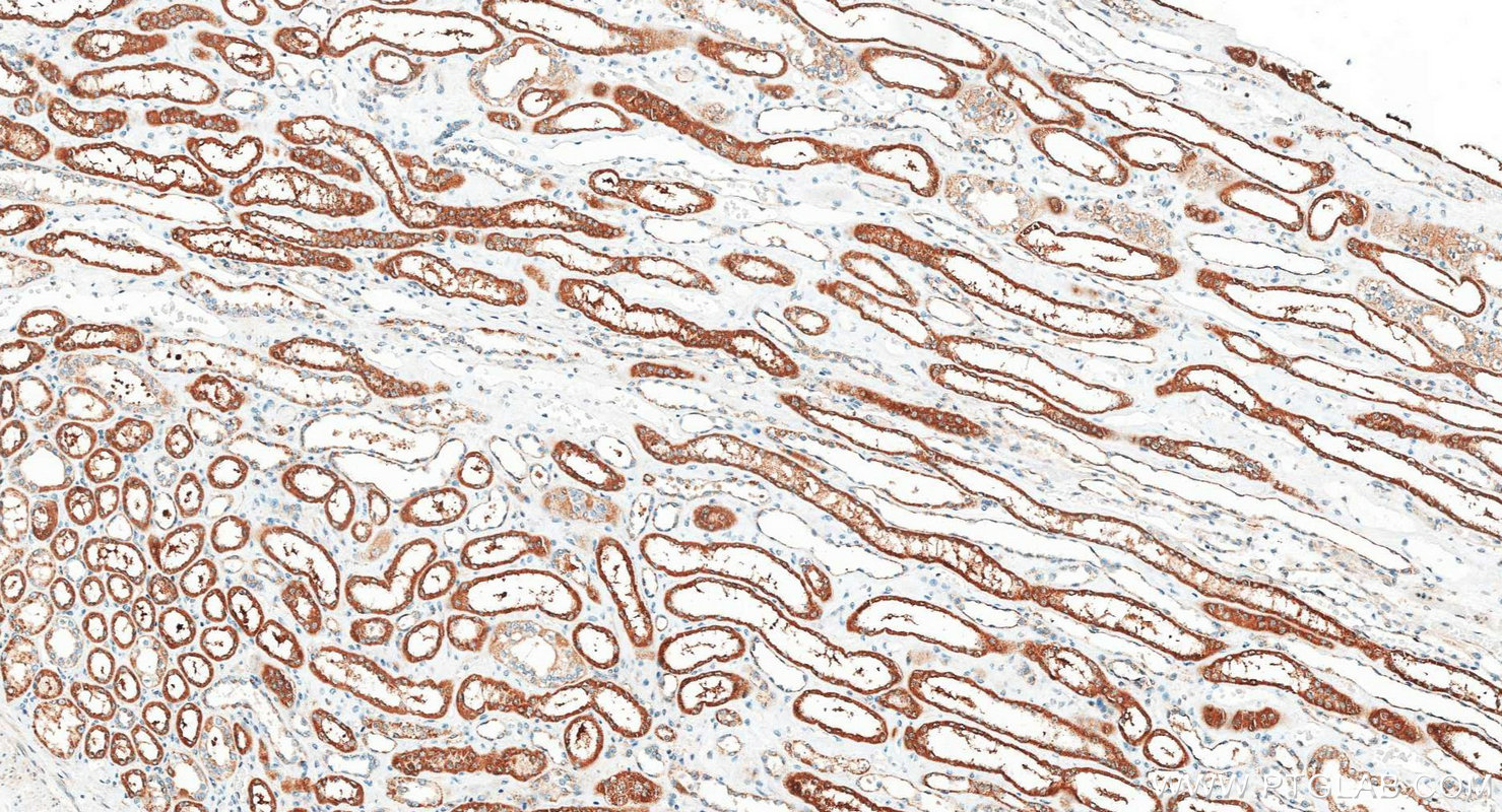 IHC staining of human kidney using 18442-1-AP