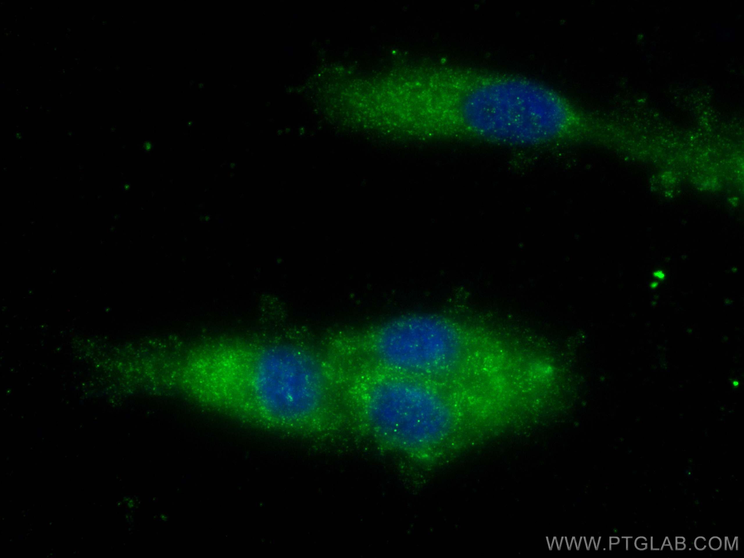 IF Staining of U-87 MG using 27538-1-AP