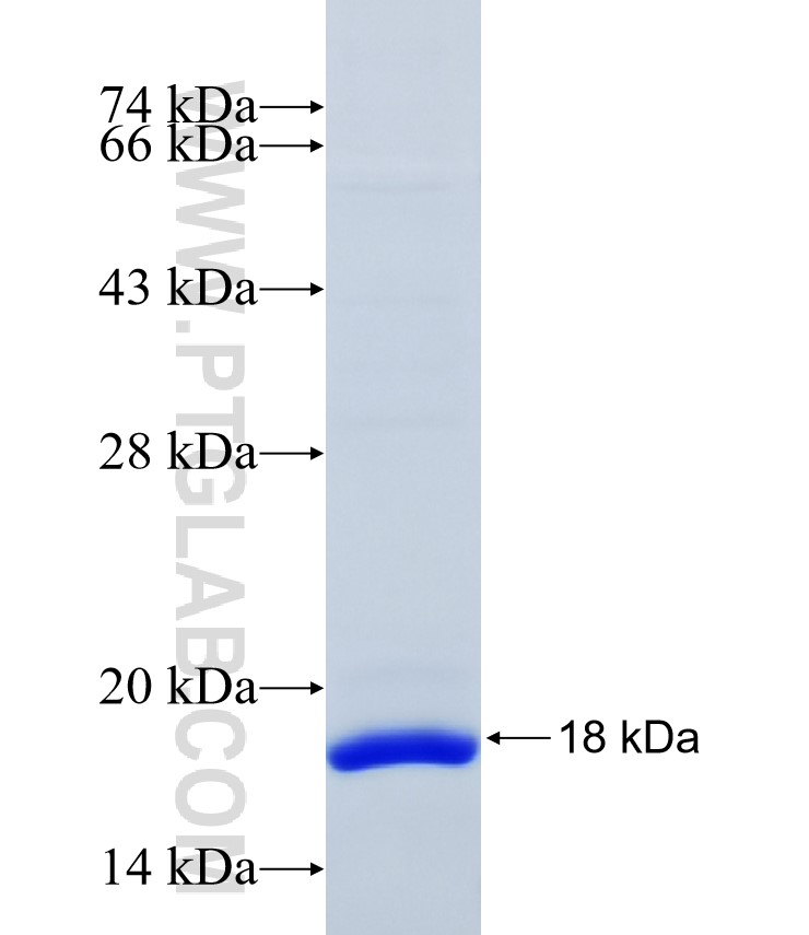 CTSS fusion protein Ag34579 SDS-PAGE CTSS fusion protein Ag34579 SDS-PAGE