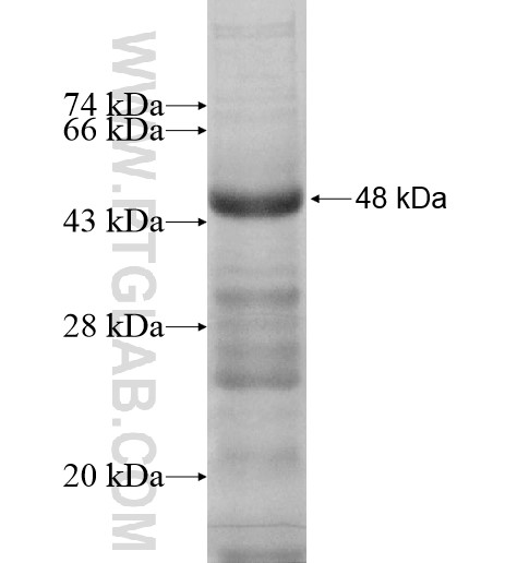 CTSW fusion protein Ag11691 SDS-PAGE CTSW fusion protein Ag11691 SDS-PAGE