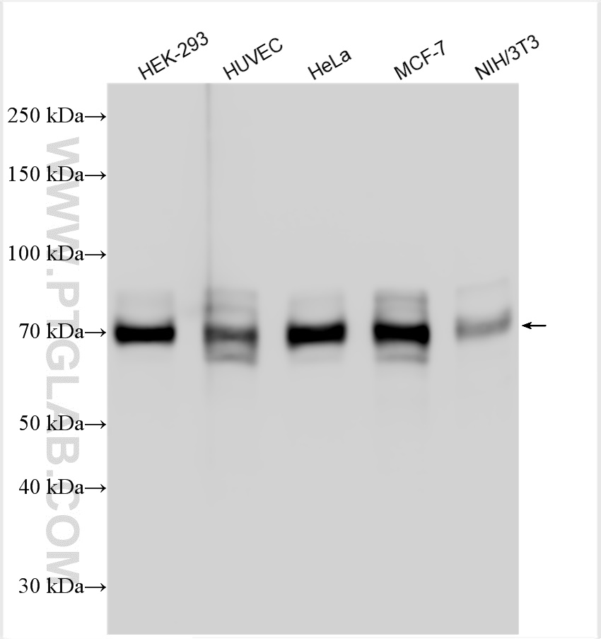 WB analysis using 11381-1-AP