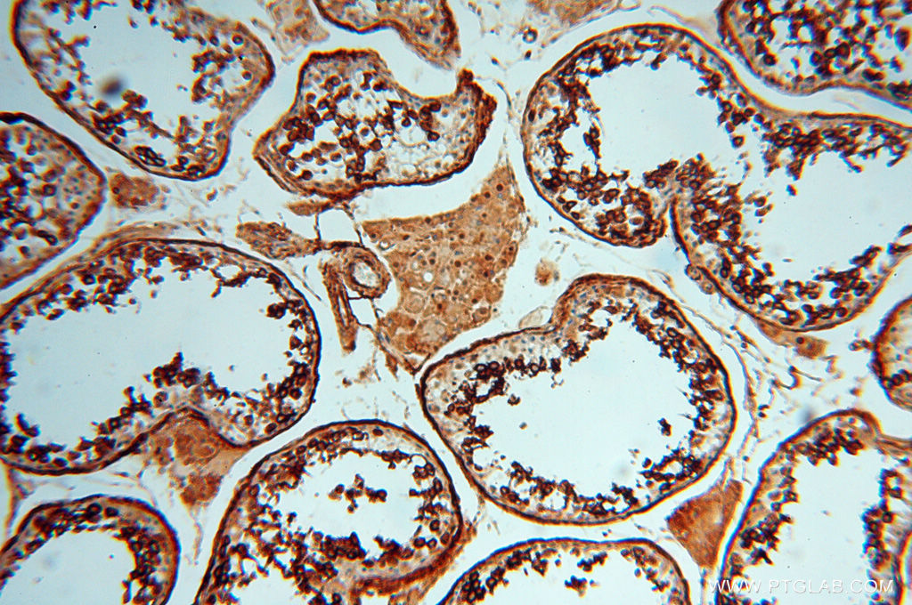 IHC staining of human testis using 17893-1-AP