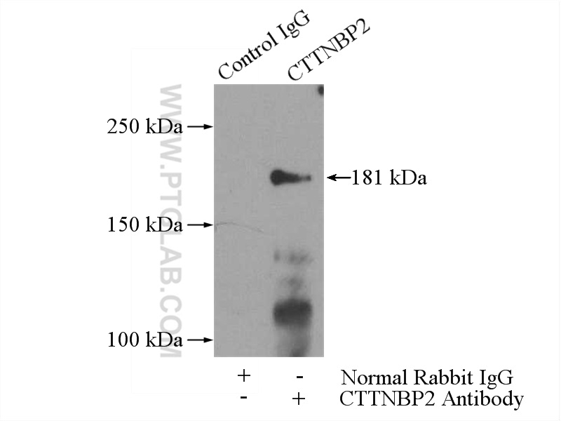 IP experiment of mouse brain using 17893-1-AP