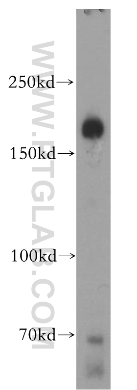 WB analysis of mouse brain using 17893-1-AP