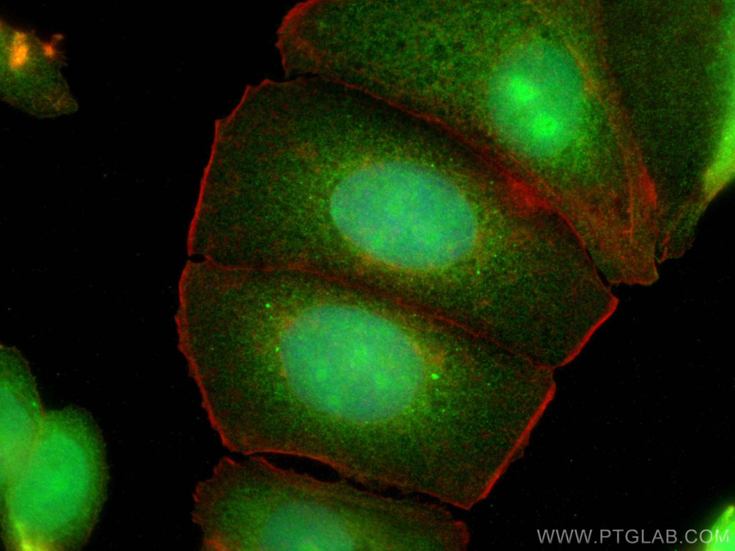 IF Staining of MCF-7 using 25523-1-AP