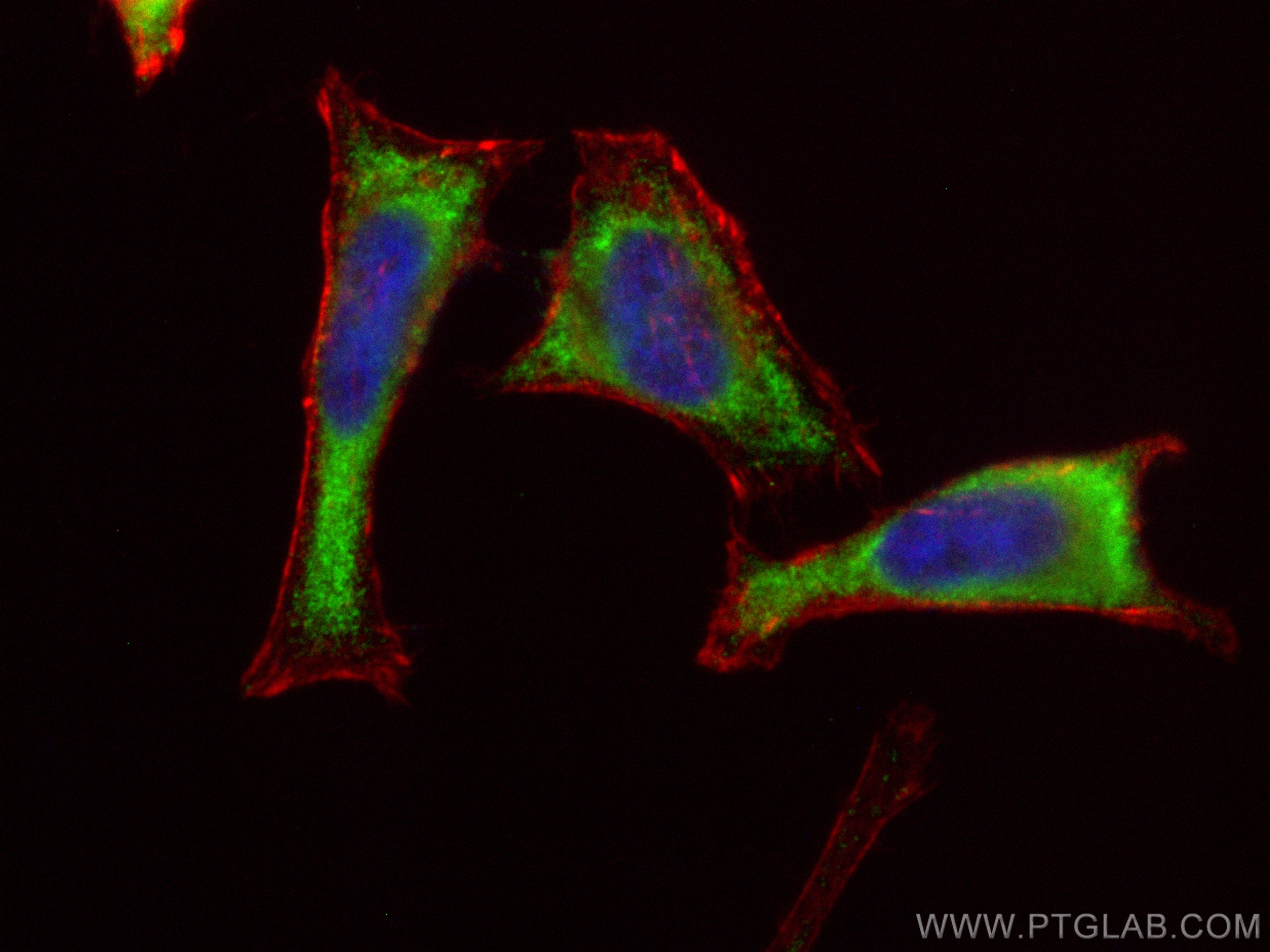IF Staining of HeLa using CL488-20123