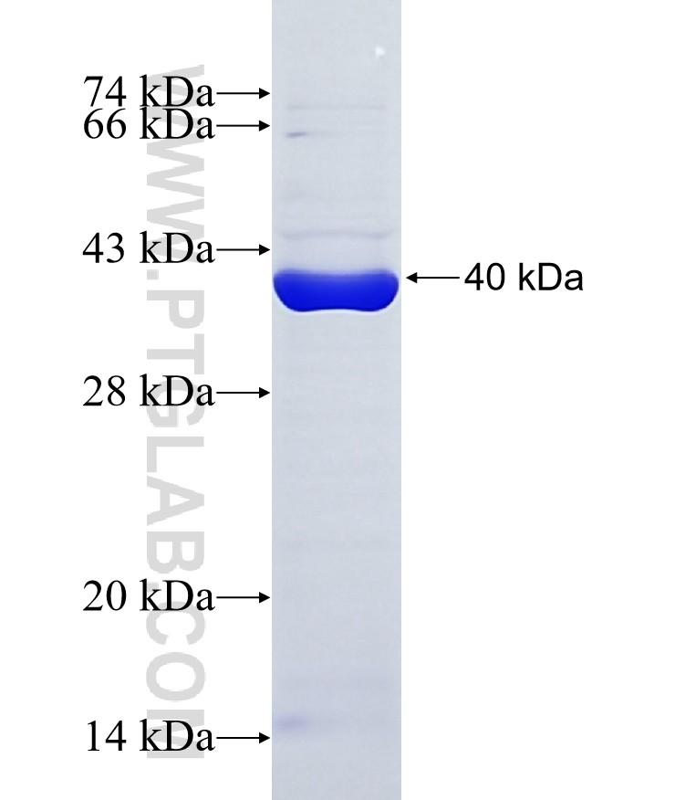 CUGBP1 fusion protein Ag14605 SDS-PAGE