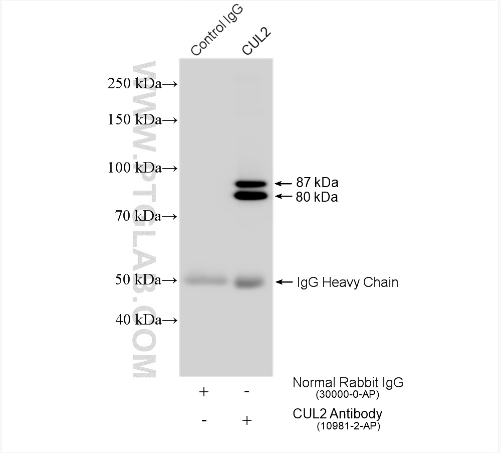 IP experiment of HeLa using 10981-2-AP