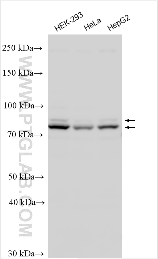 WB analysis using 10981-2-AP