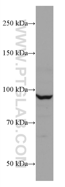 WB analysis of MCF-7 using 67175-1-Ig