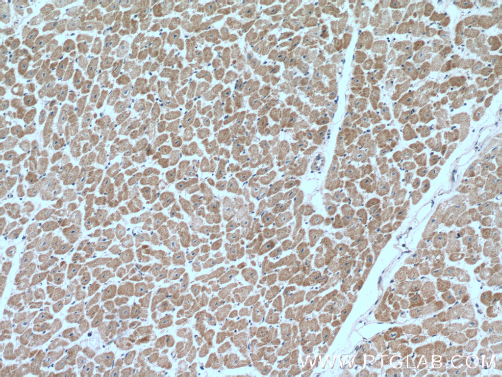 IHC staining of human heart using 10693-1-AP