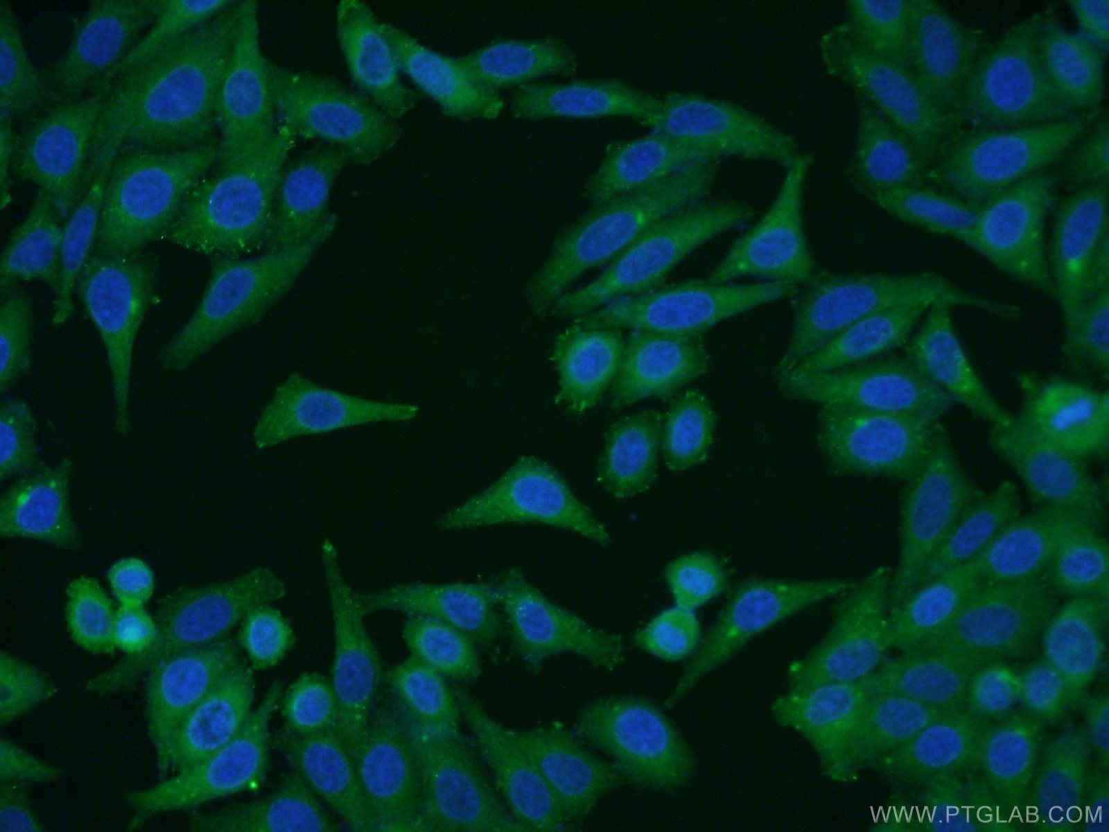 IF Staining of HepG2 using 66038-1-Ig (same clone as 66038-1-PBS)