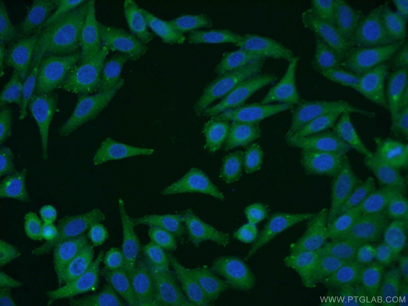 IF Staining of HepG2 using 66038-1-Ig