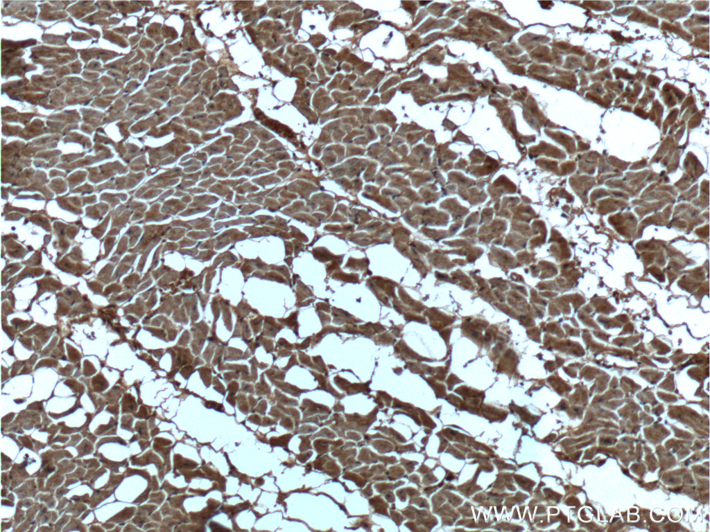 IHC staining of human heart using 66038-1-Ig (same clone as 66038-1-PBS)
