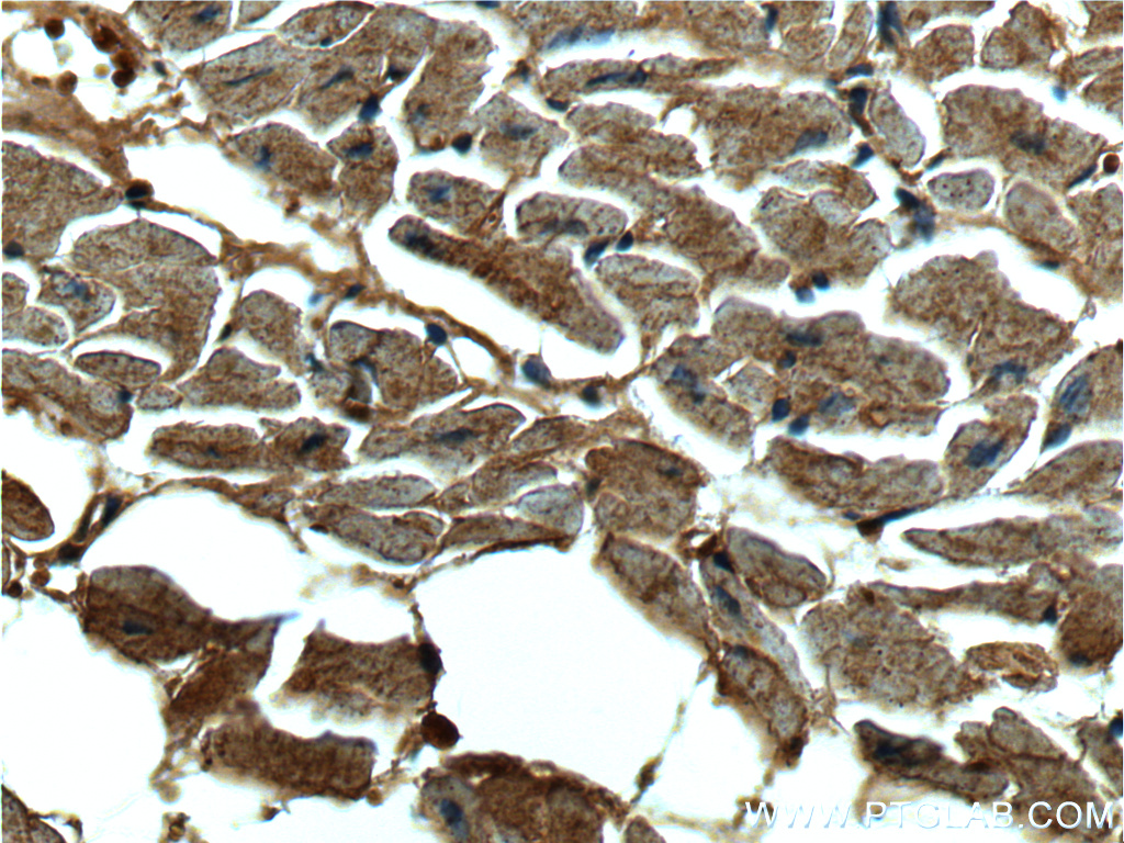 IHC staining of human heart using 66038-1-Ig (same clone as 66038-1-PBS)