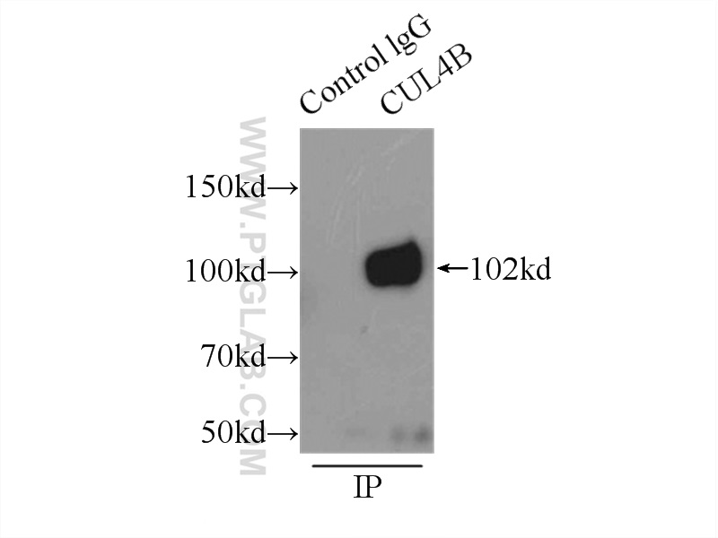 IP experiment of HeLa using 12916-1-AP