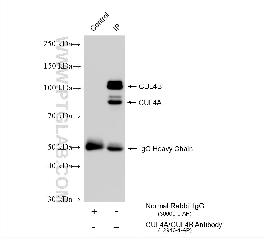 IP experiment of HeLa using 12916-1-AP IP experiment of HeLa using 12916-1-AP