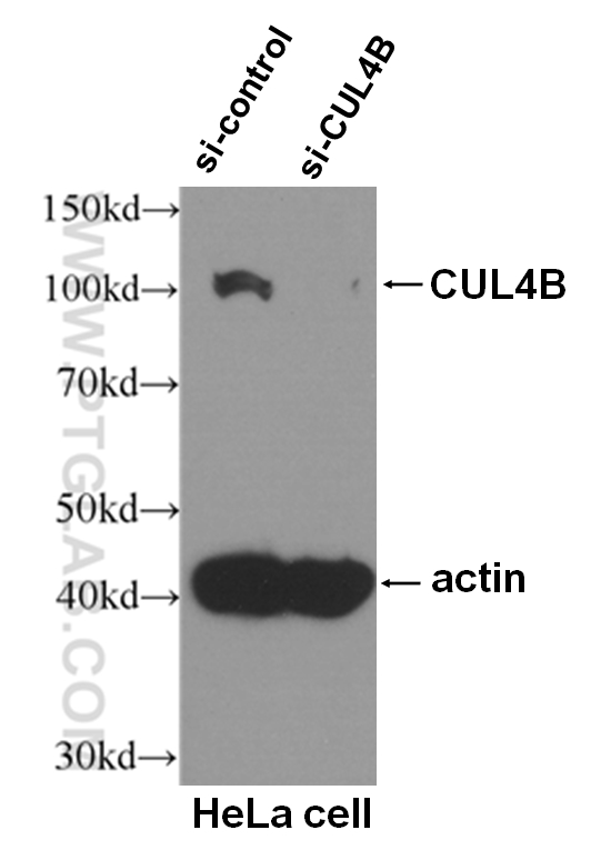 WB analysis of HeLa cells using 60151-1-Ig (same clone as 60151-1-PBS)
