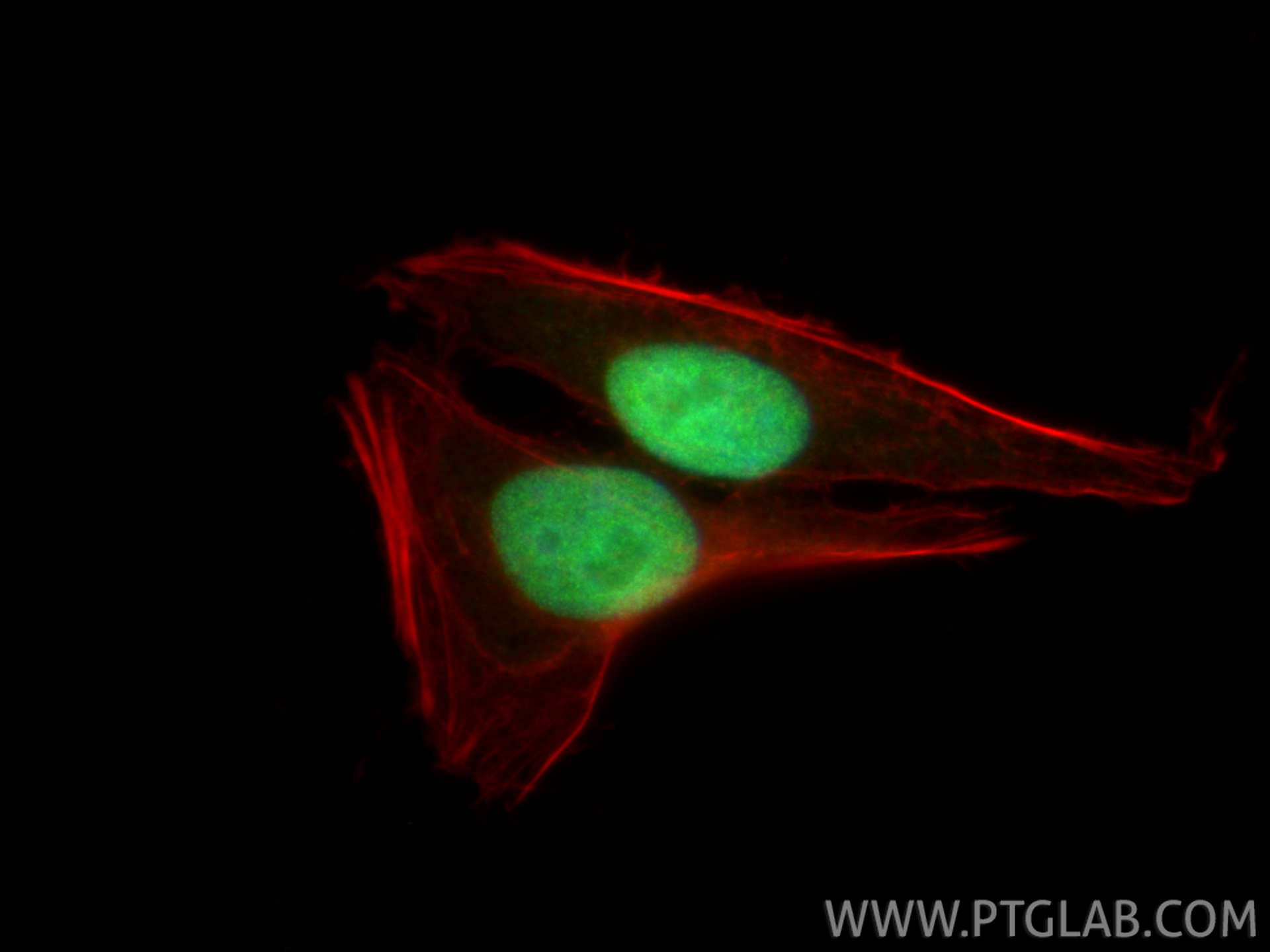 IF Staining of HepG2 using 85001-4-RR IF Staining of HepG2 using 85001-4-RR