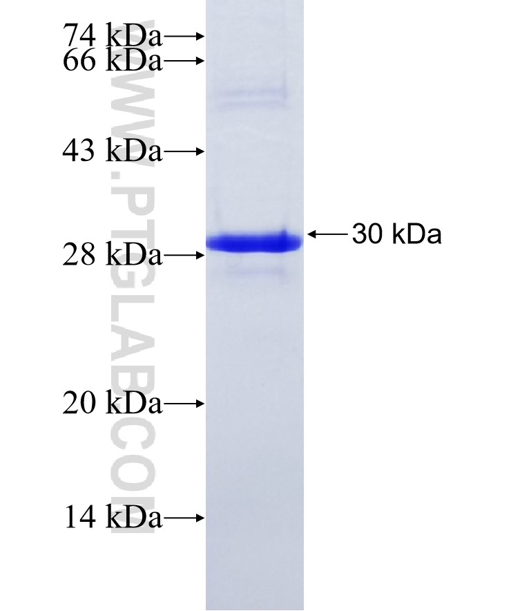 CUL4B fusion protein Ag15441 SDS-PAGE