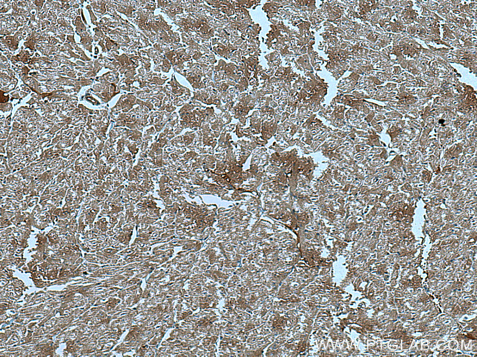 IHC staining of human heart using 67034-1-Ig