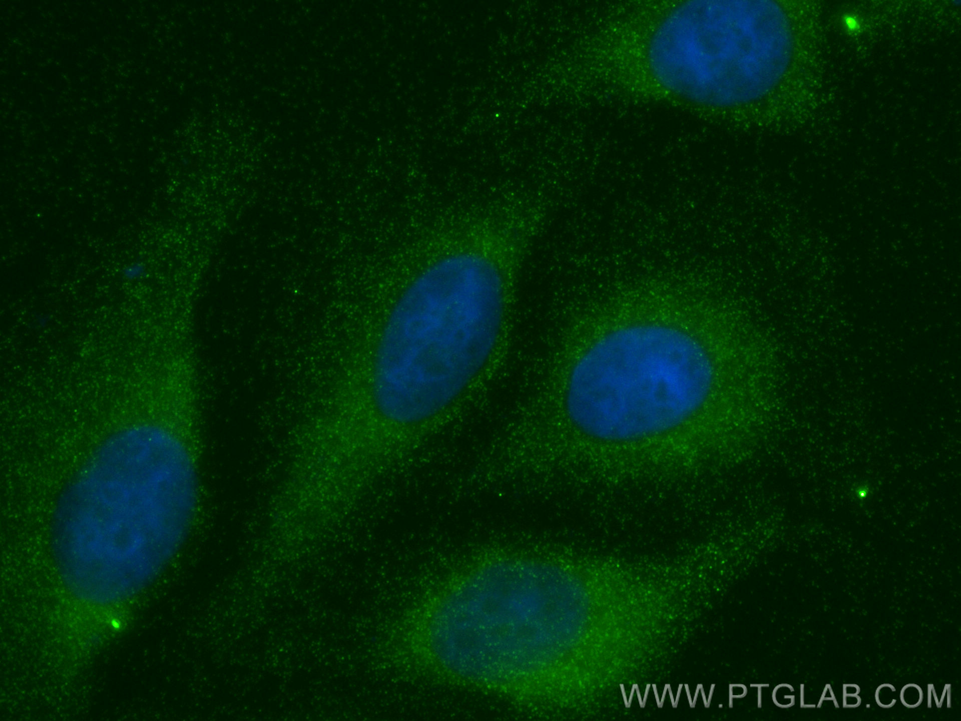 IF Staining of U2OS using 31220-1-AP