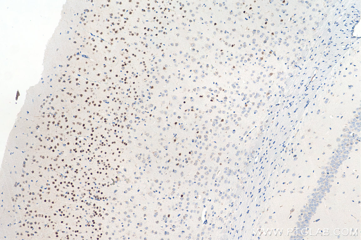 IHC staining of mouse brain using 11733-1-AP