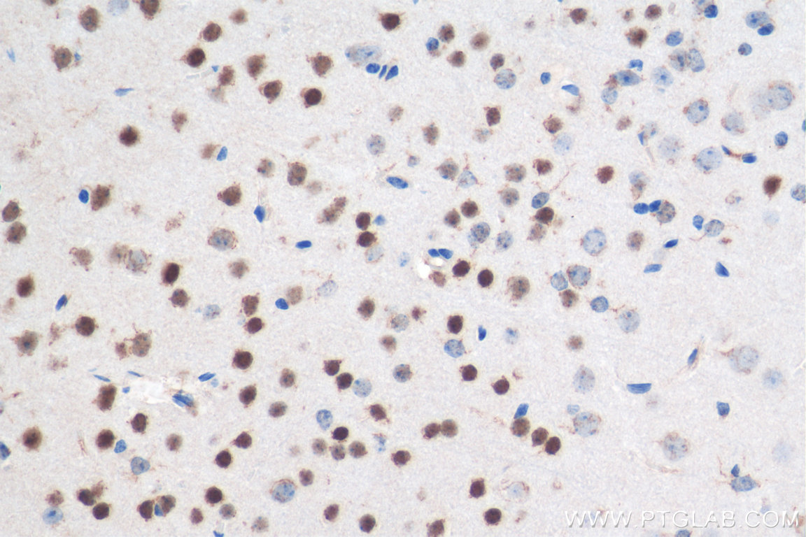 IHC staining of mouse brain using 11733-1-AP