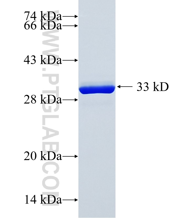 CUZD1 fusion protein Ag24335 SDS-PAGE CUZD1 fusion protein Ag24335 SDS-PAGE