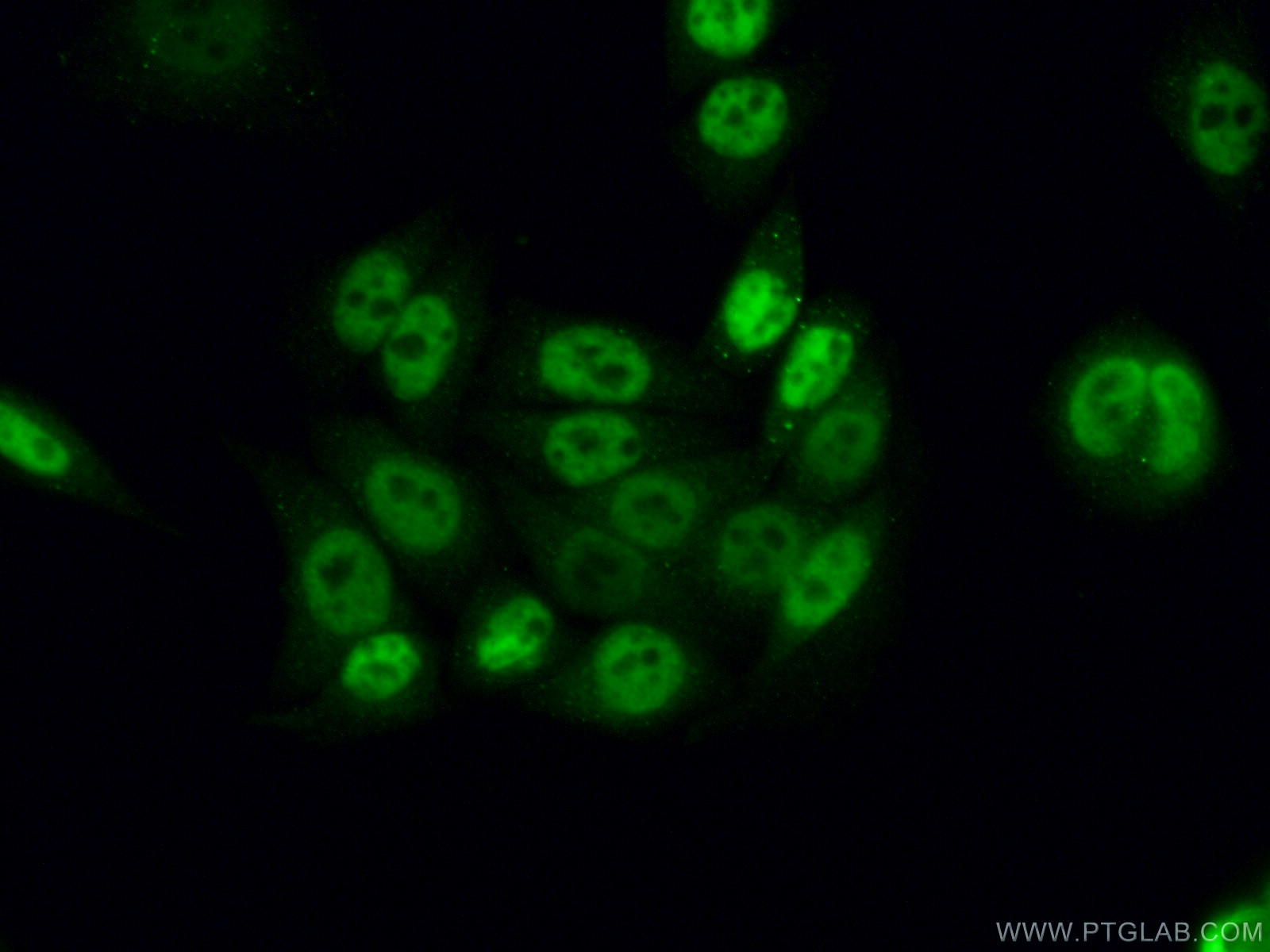 IF Staining of HeLa using 25293-1-AP