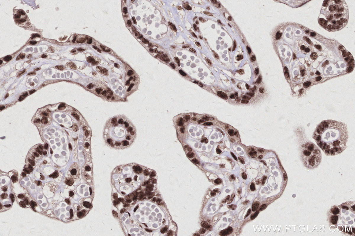IHC staining of human placenta using 25293-1-AP