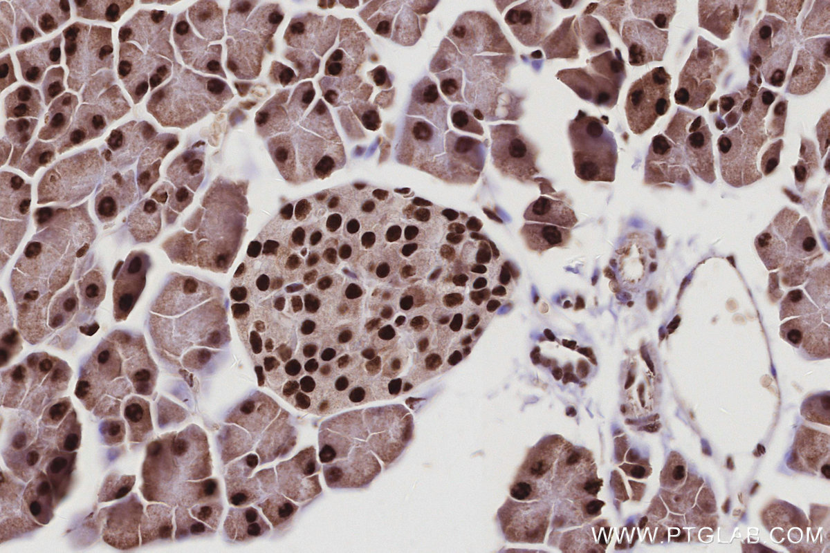 IHC staining of mouse pancreas using 25293-1-AP