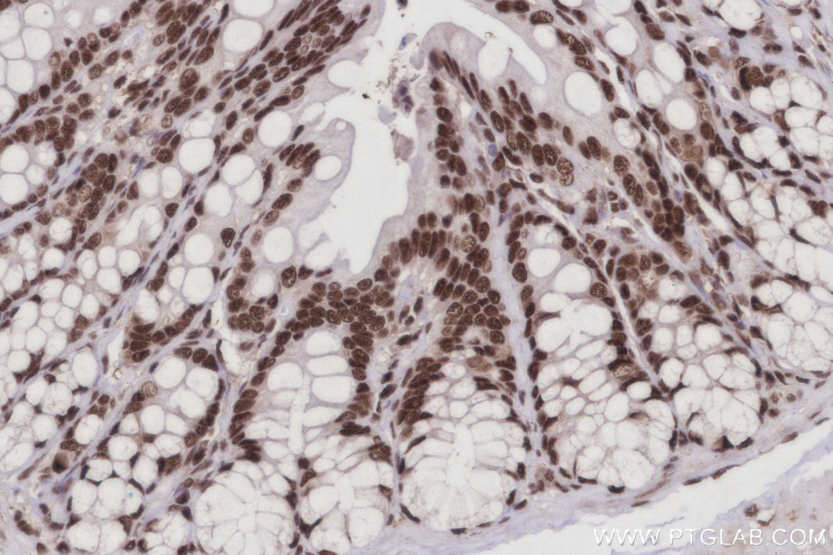 IHC staining of rat colon using 25293-1-AP