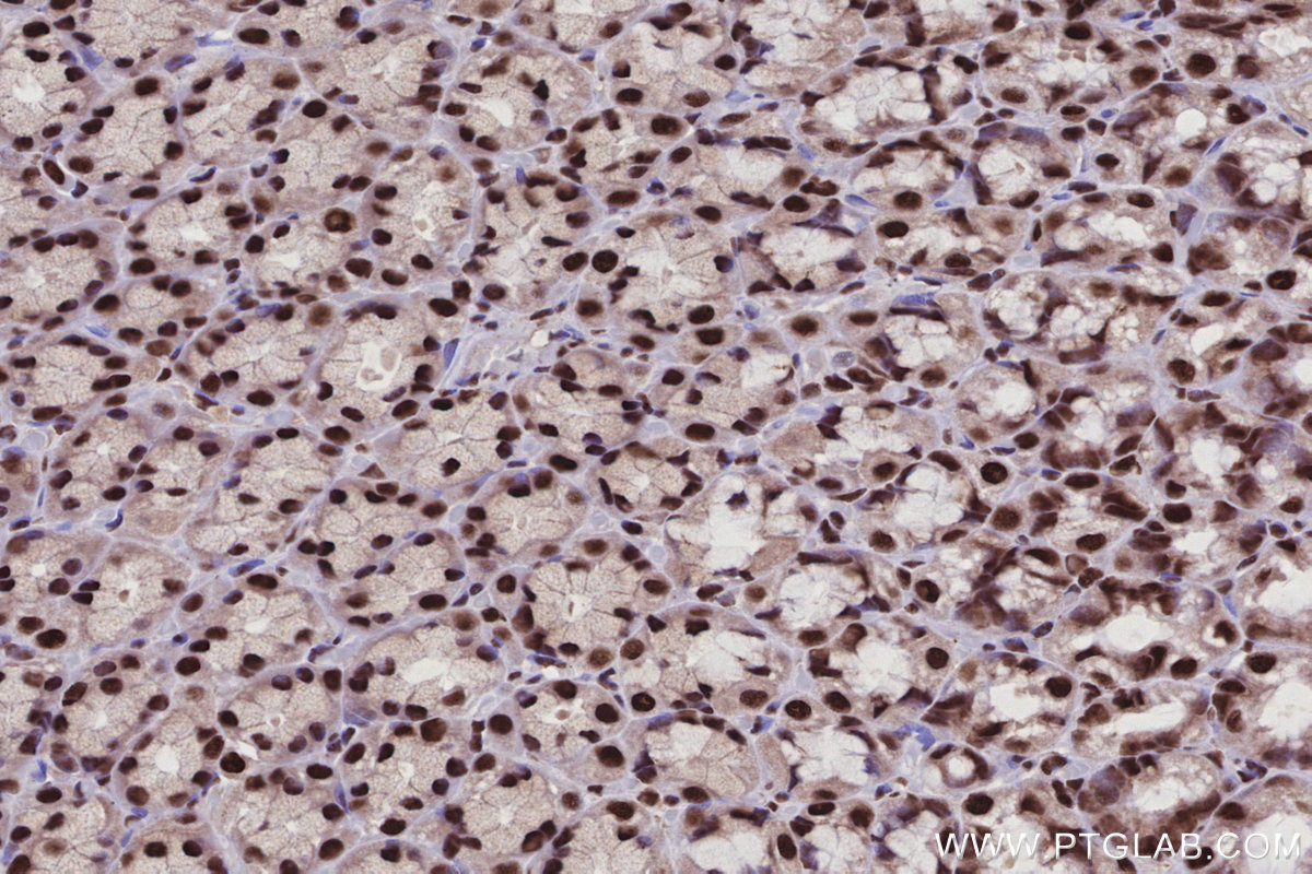 IHC staining of rat stomach using 25293-1-AP