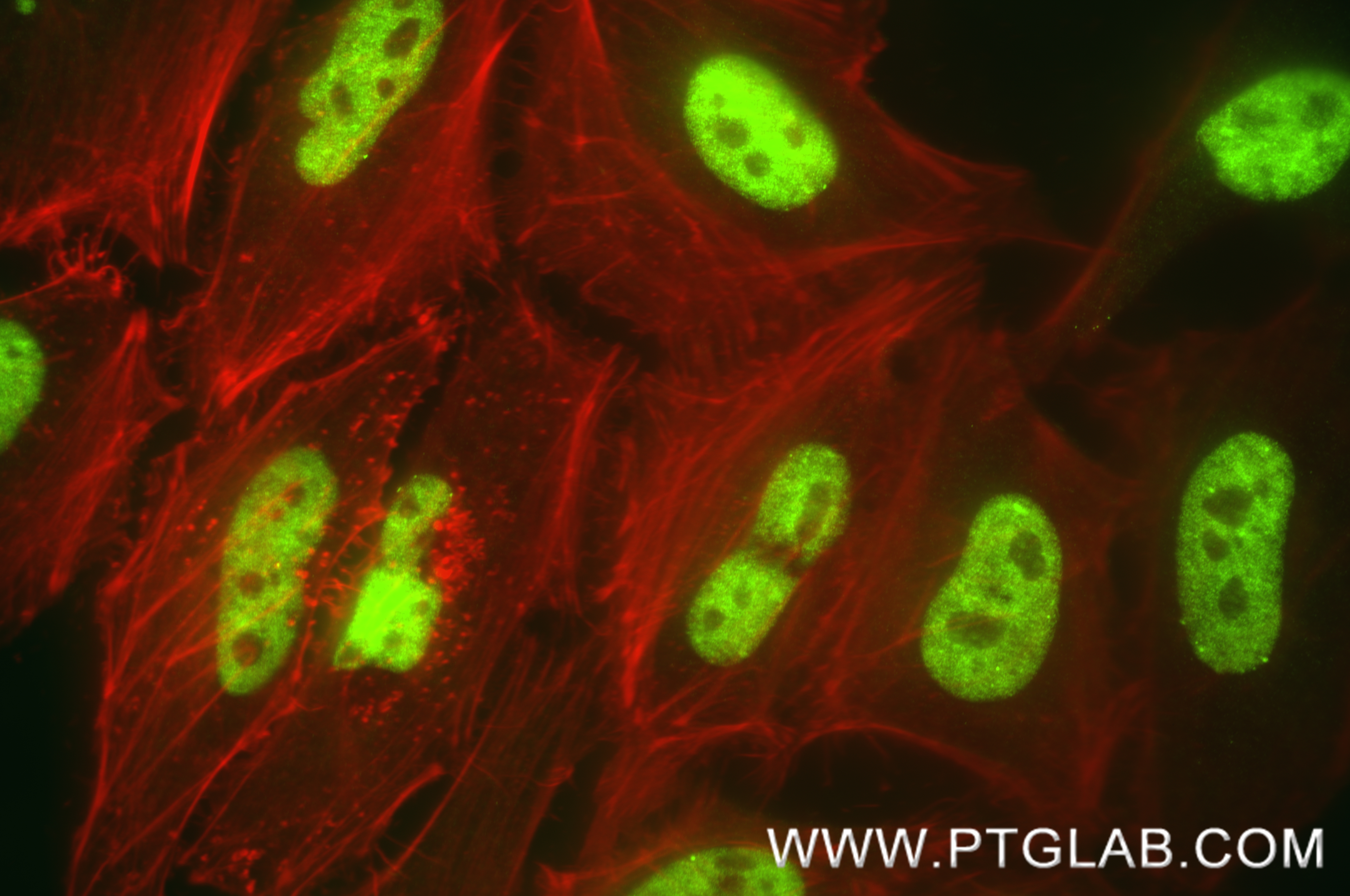 IF Staining of HeLa using 87890-1-RR (same clone as 87890-1-PBS)