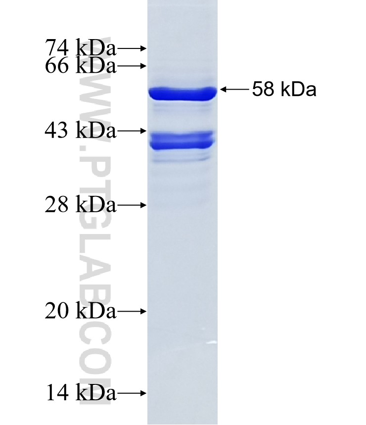 CWC15 fusion protein Ag18116 SDS-PAGE