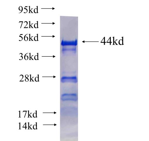 CWC22 fusion protein Ag25466 SDS-PAGE