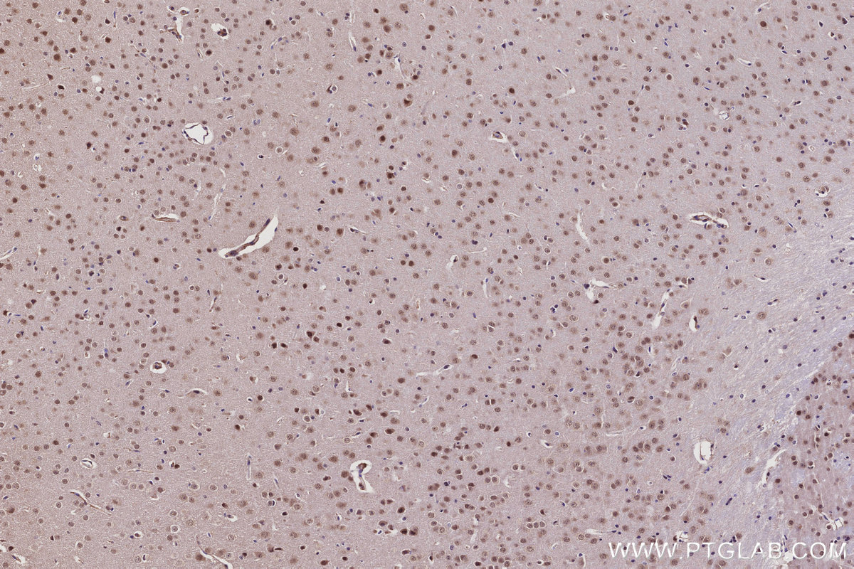 IHC staining of mouse brain using 31700-1-AP IHC staining of mouse brain using 31700-1-AP