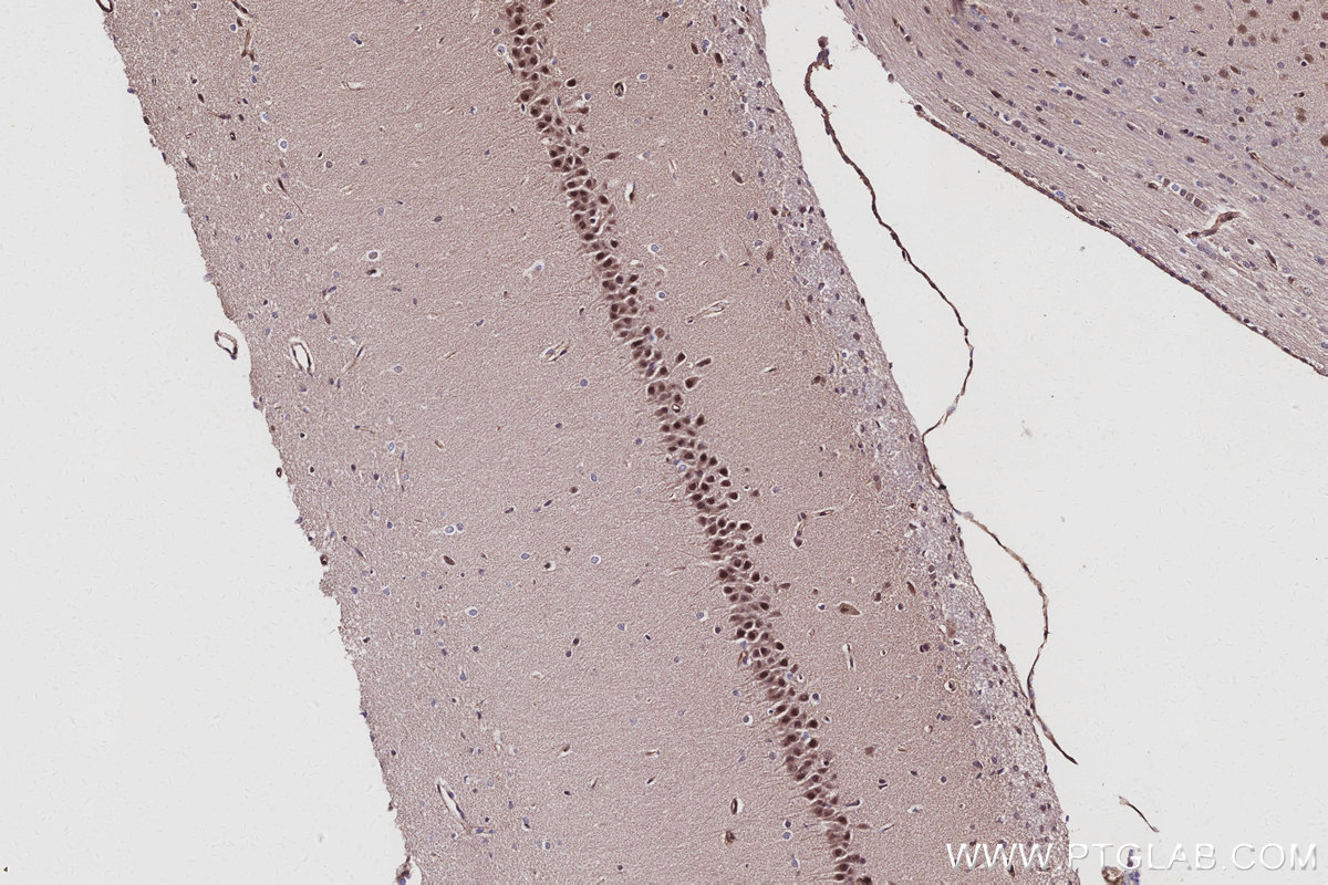 IHC staining of rat brain using 31700-1-AP IHC staining of rat brain using 31700-1-AP