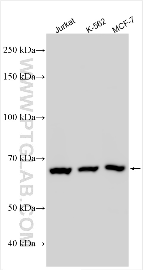 WB analysis using 31700-1-AP