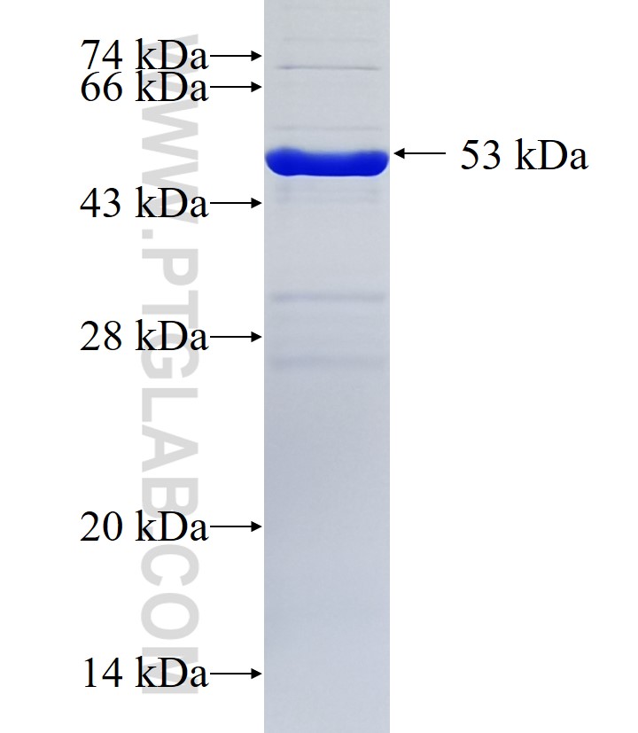 CWF19L1 fusion protein Ag36356 SDS-PAGE