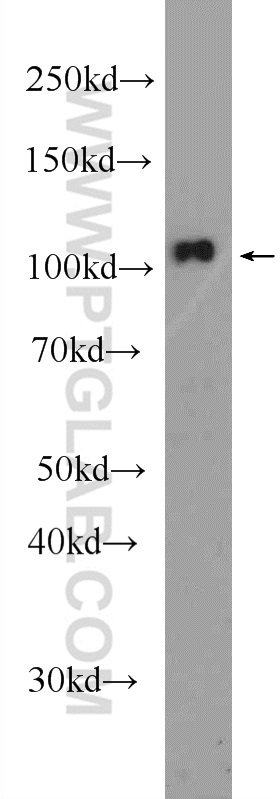 WB analysis of HeLa using 24872-1-AP