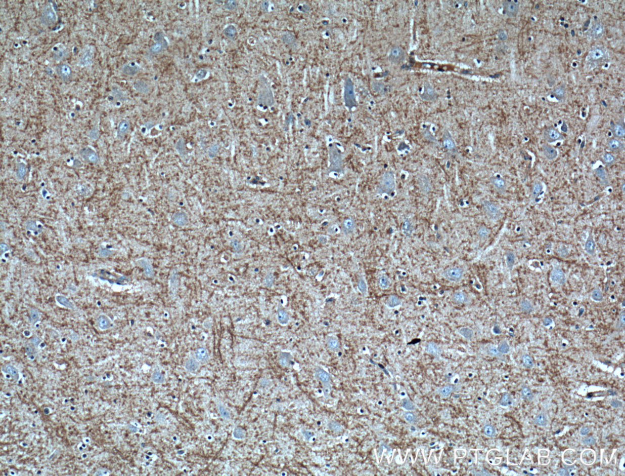 IHC staining of human brain using 60339-1-Ig