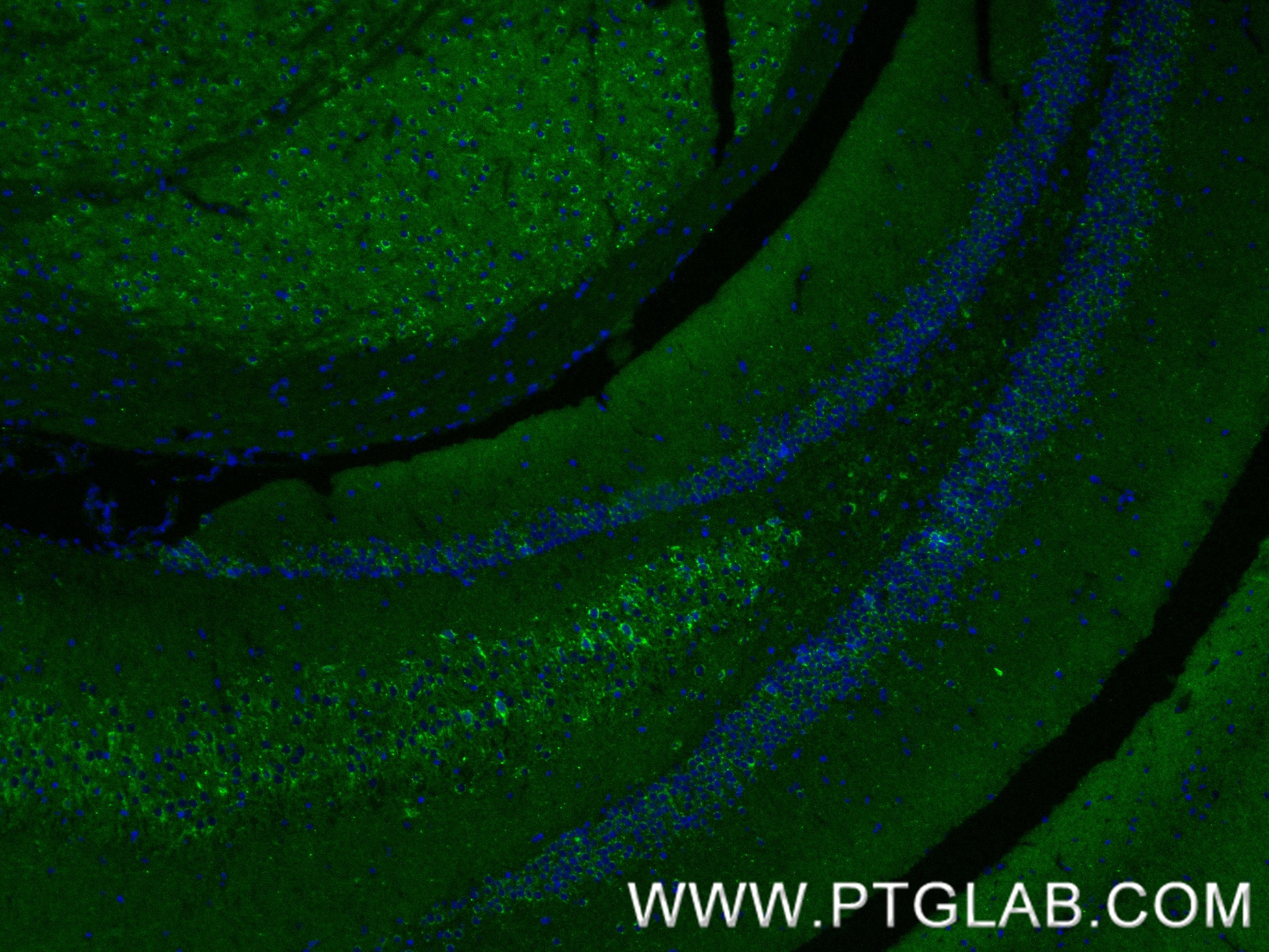 IF Staining of mouse brain using 83738-5-RR