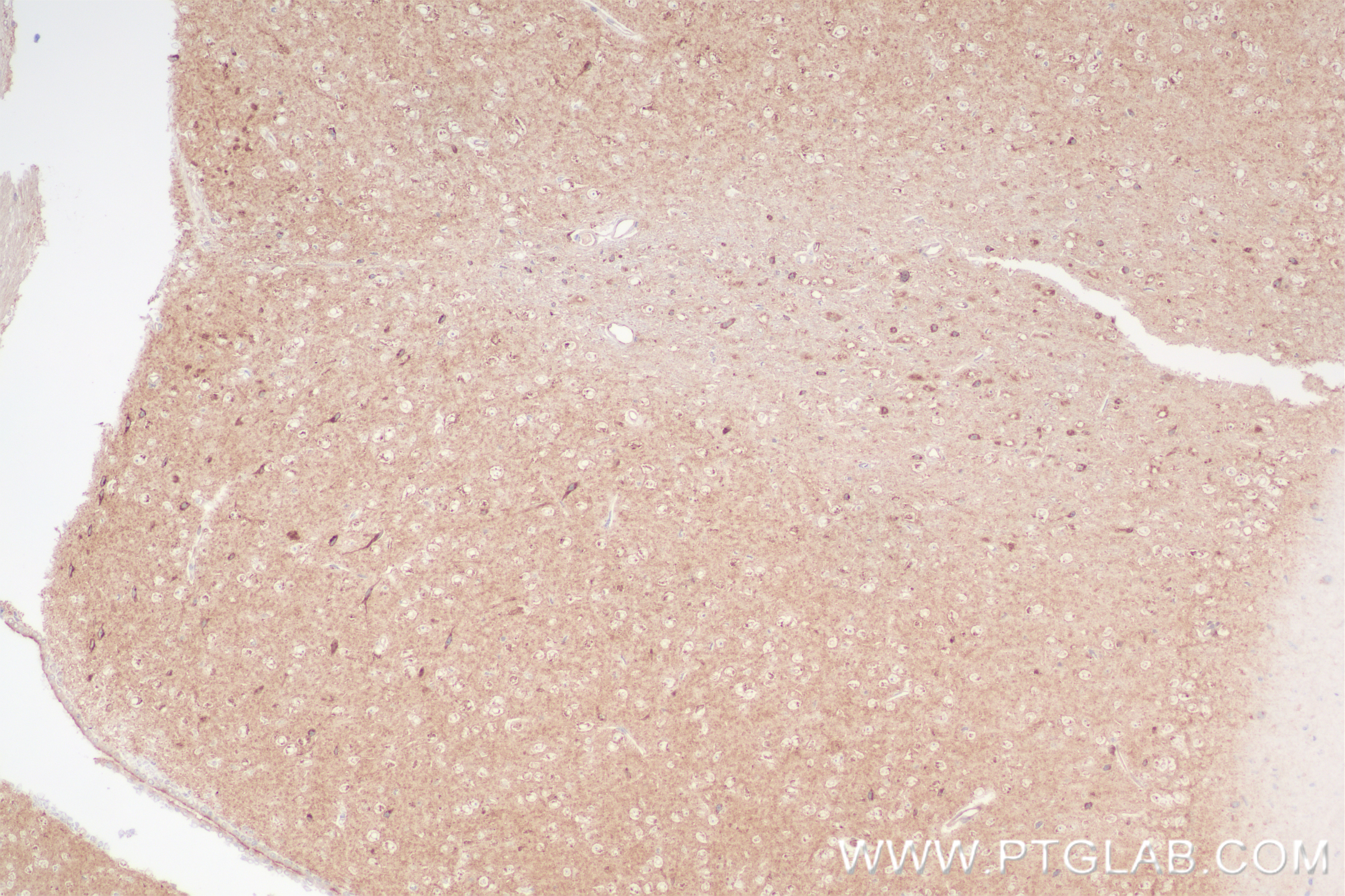 IHC staining of mouse brain using 83738-5-RR