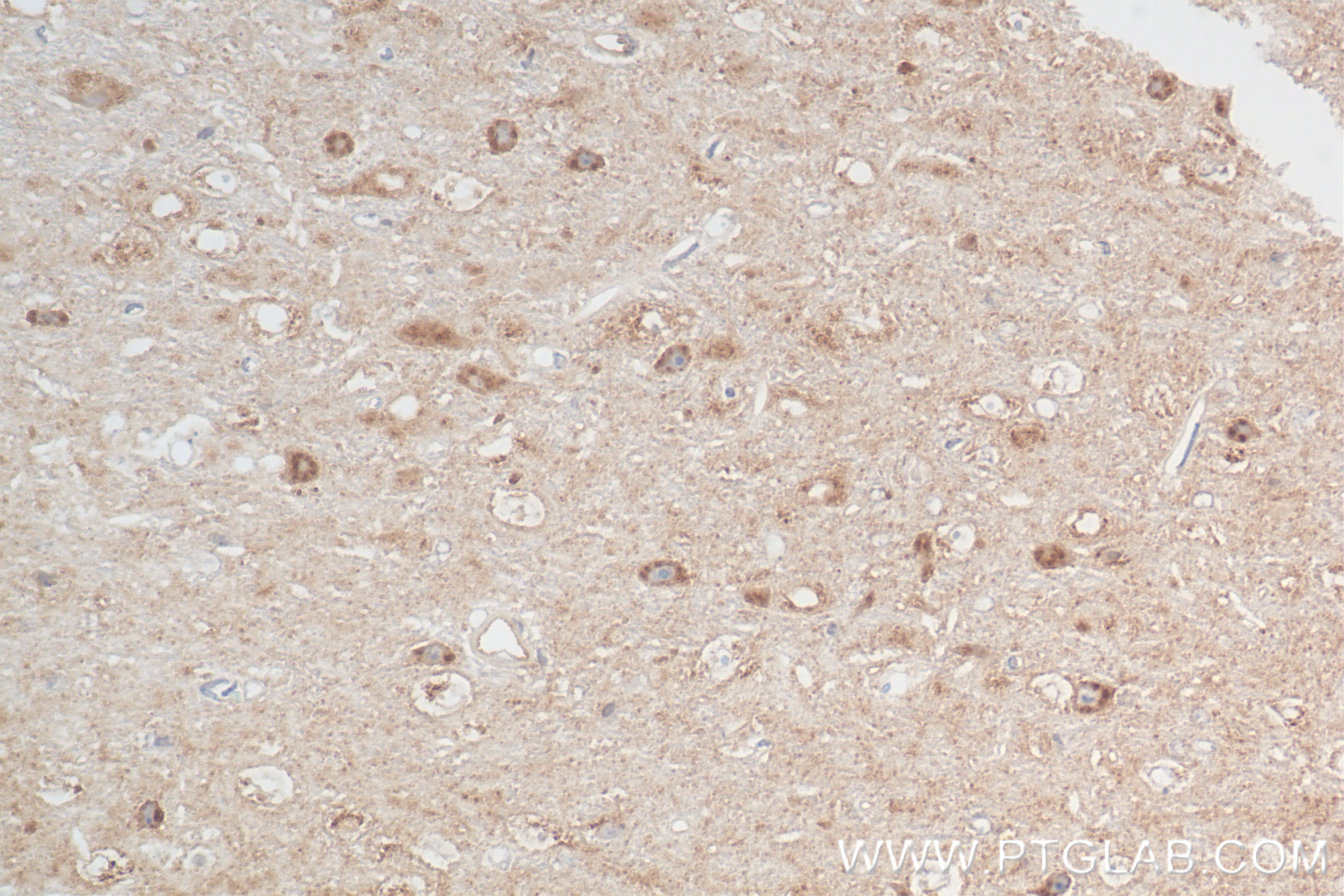 IHC staining of mouse brain using 83738-5-RR