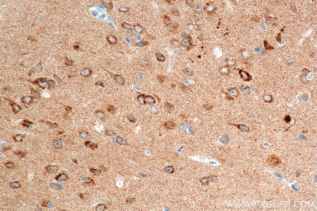 IHC staining of mouse brain using 85353-2-RR (same clone as 85353-2-PBS) IHC staining of mouse brain using 85353-2-RR (same clone as 85353-2-PBS)