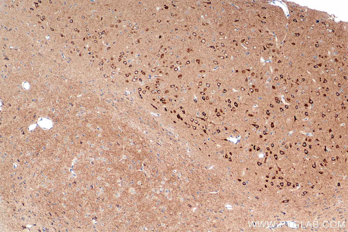 IHC staining of rat brain using 85353-2-RR (same clone as 85353-2-PBS) IHC staining of rat brain using 85353-2-RR (same clone as 85353-2-PBS)