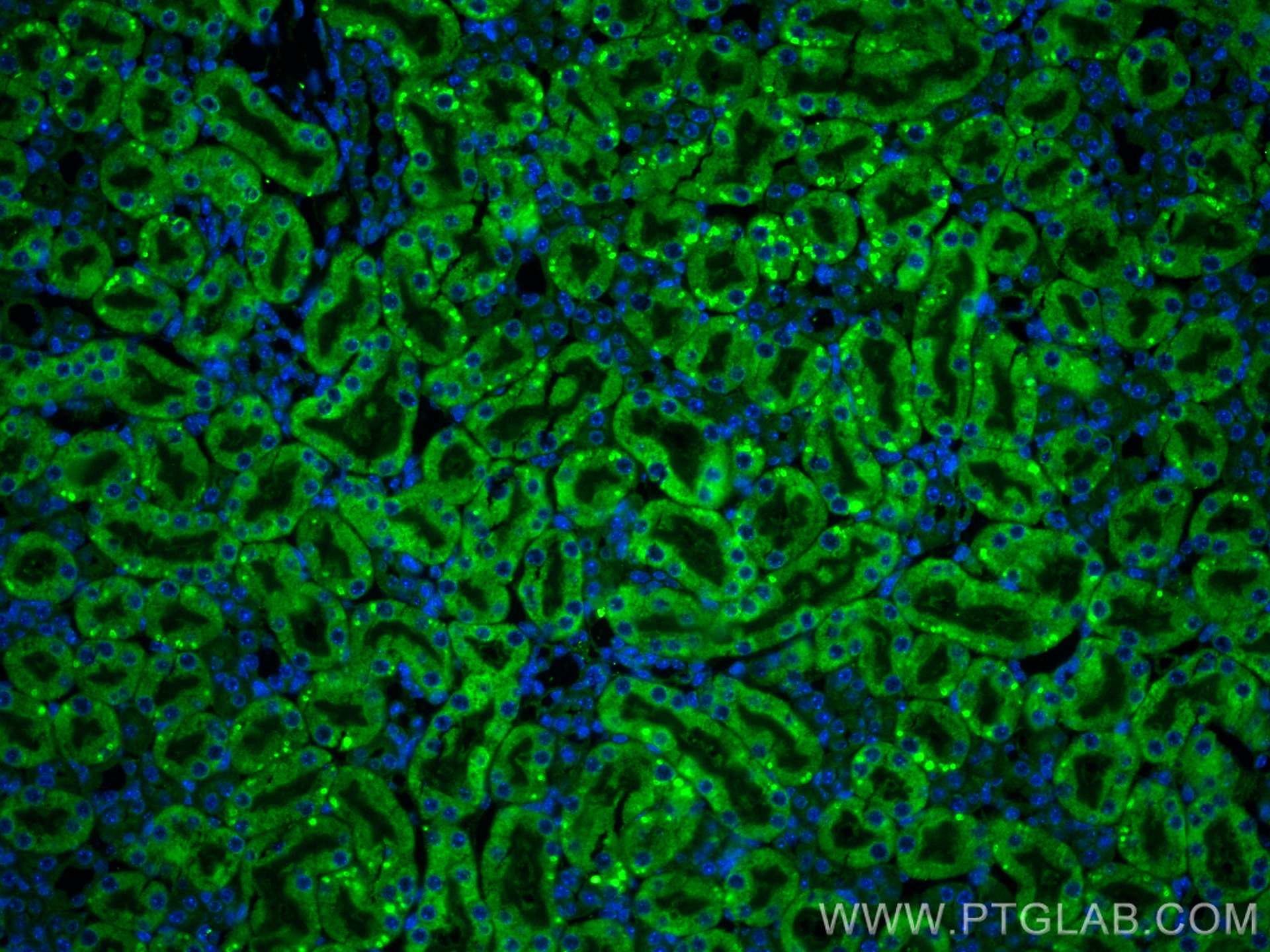 IF Staining of mouse kidney using 13885-1-AP