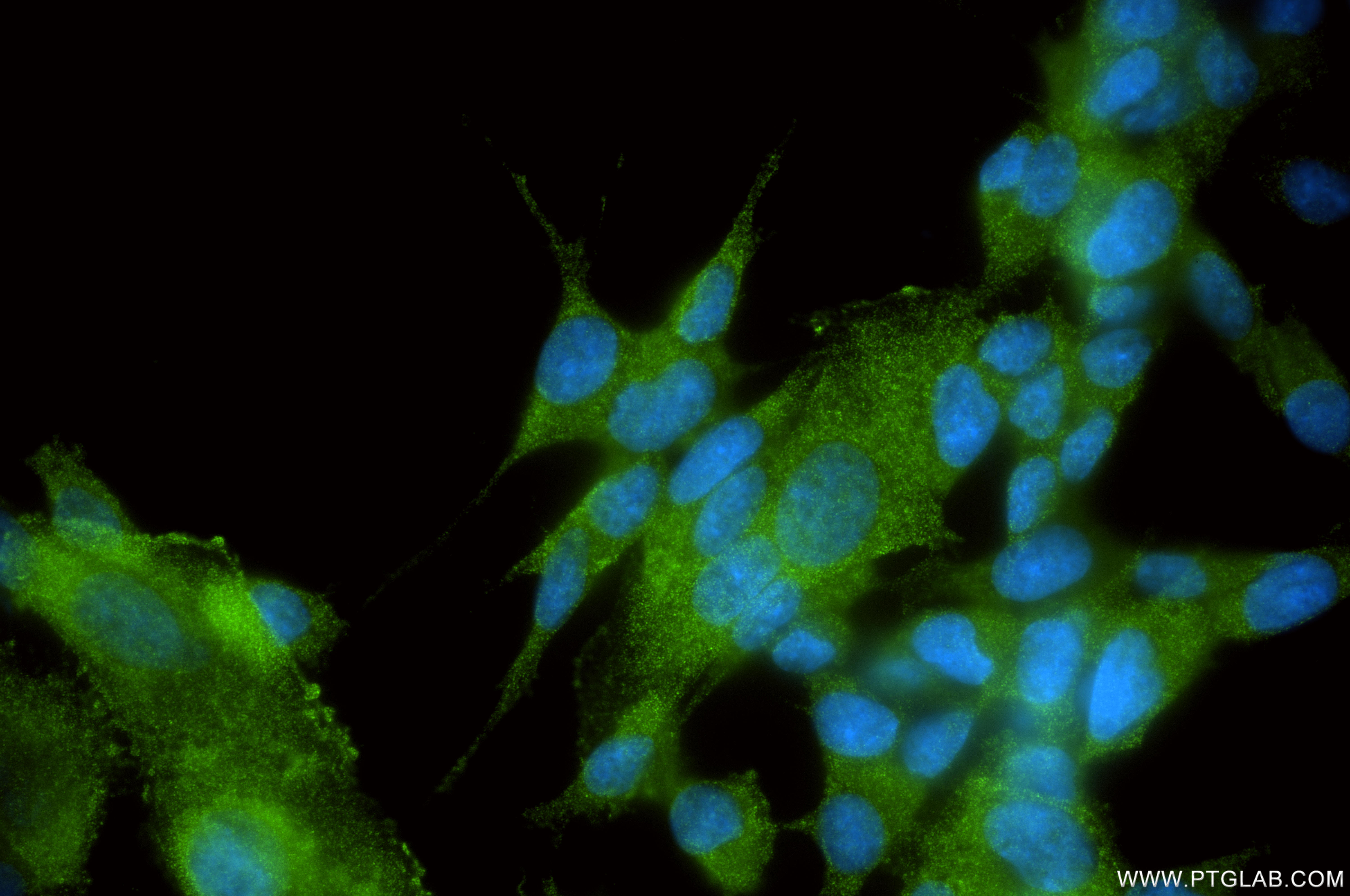 IF Staining of SH-SY5Y using 82183-2-RR (same clone as 82183-2-PBS) IF Staining of SH-SY5Y using 82183-2-RR (same clone as 82183-2-PBS)